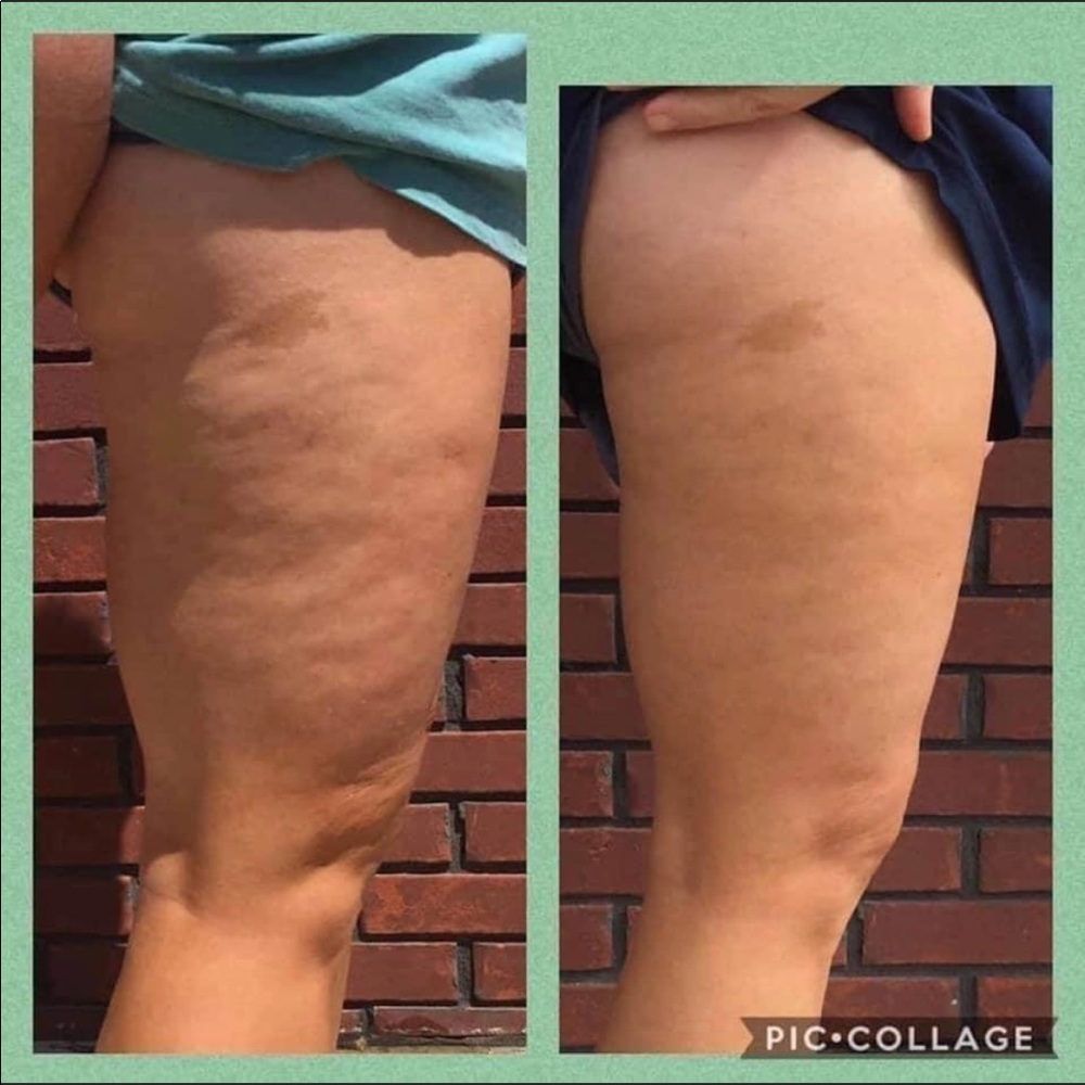 Dermatic Effects Cellulite Cream